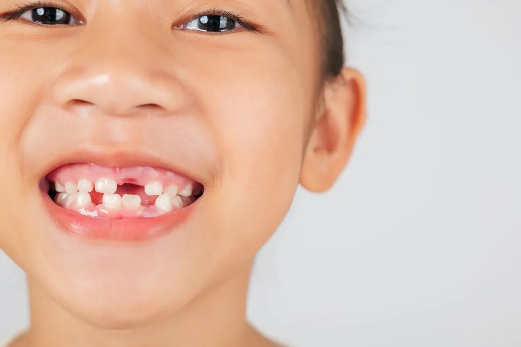 children knocked out teeth